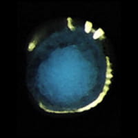 Inverted image of a lateral view of an embryo probed for cocktail of in situ probes.